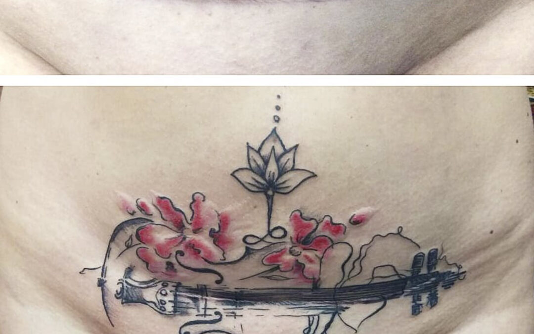 Un violín, tatuaje sobre una cesárea