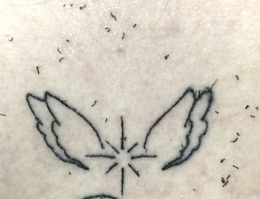Caída de la piel durante la curación de un tatuaje
