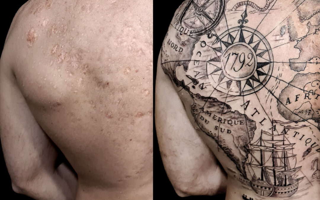Tatuaje reparador sobre cicatrices en la espalda