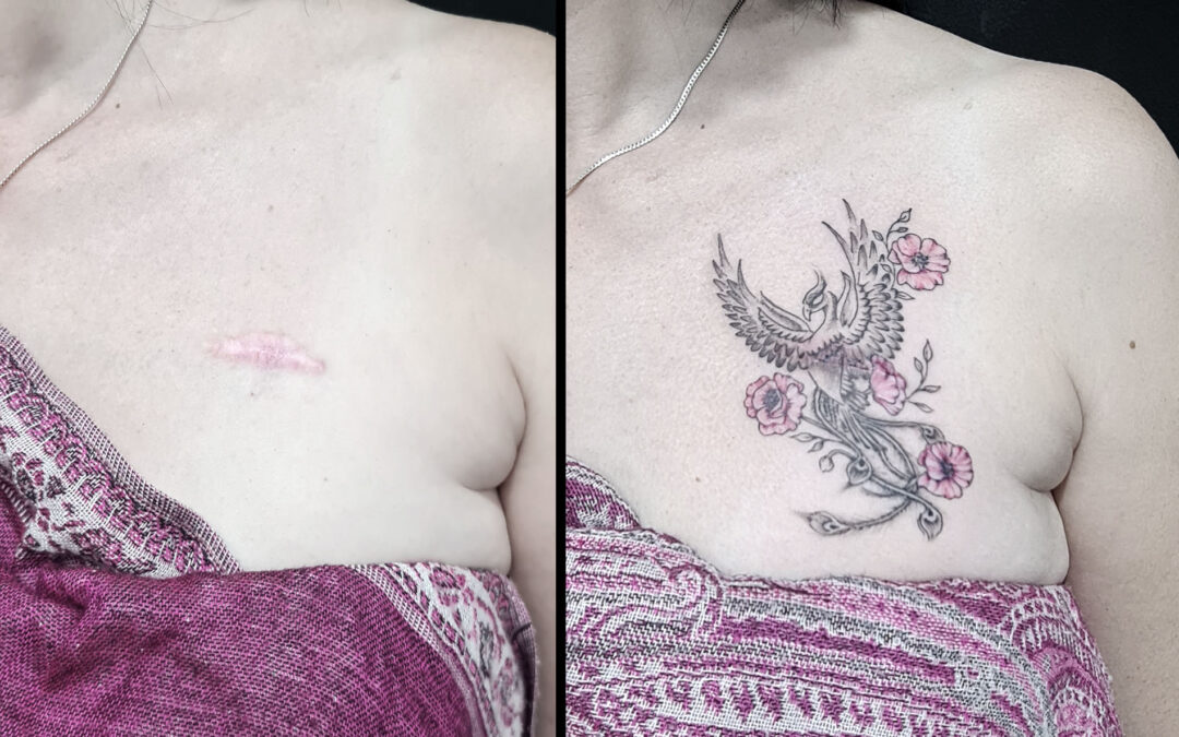 Tatuaje para cubrir el reservorio del cáncer de mama