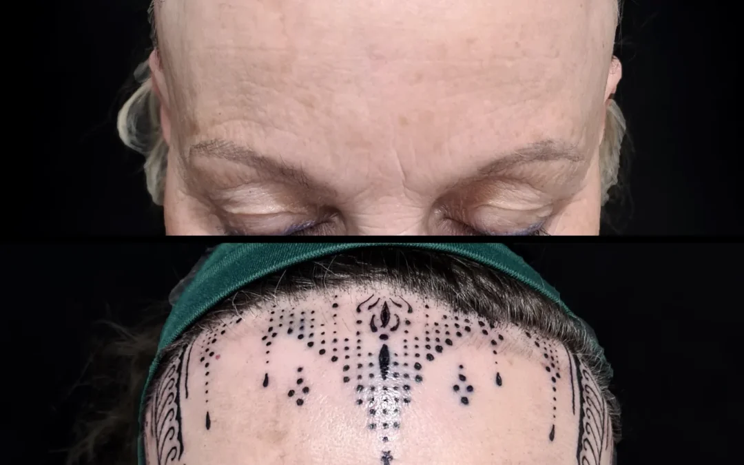 La Alopecia y el tatuaje