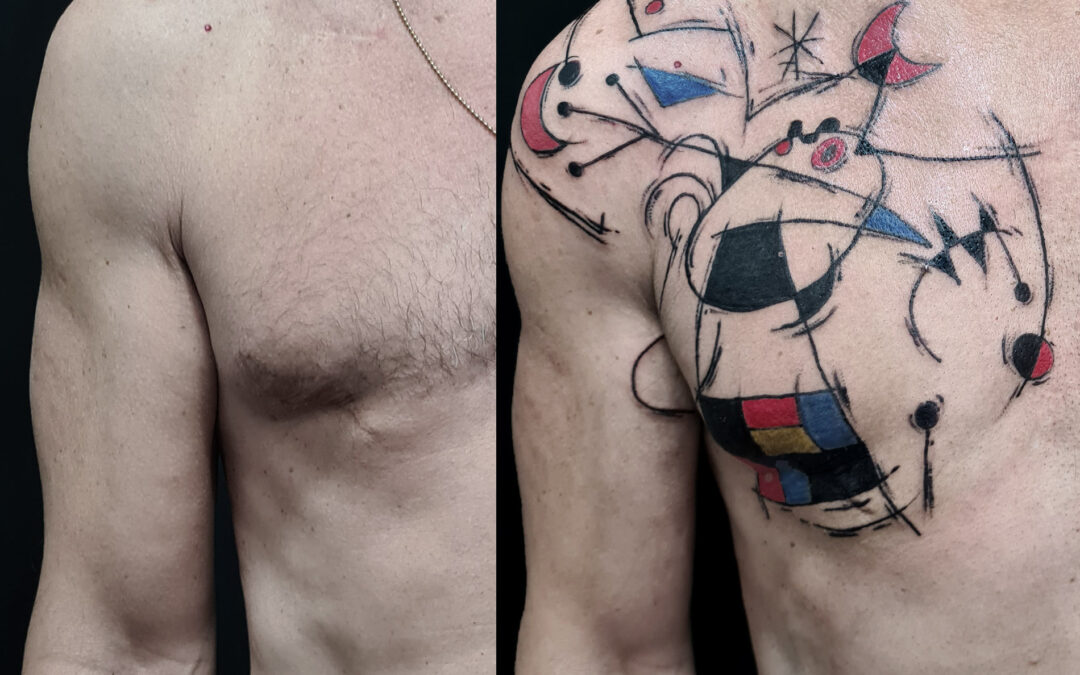 Tatuar sobre la cicatriz de un tumor pecho masculino
