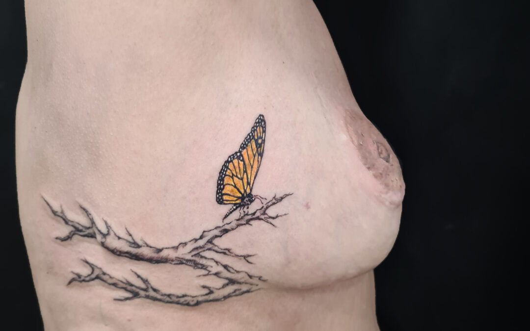 Cubrir una Cicatriz en el pecho con tatuaje