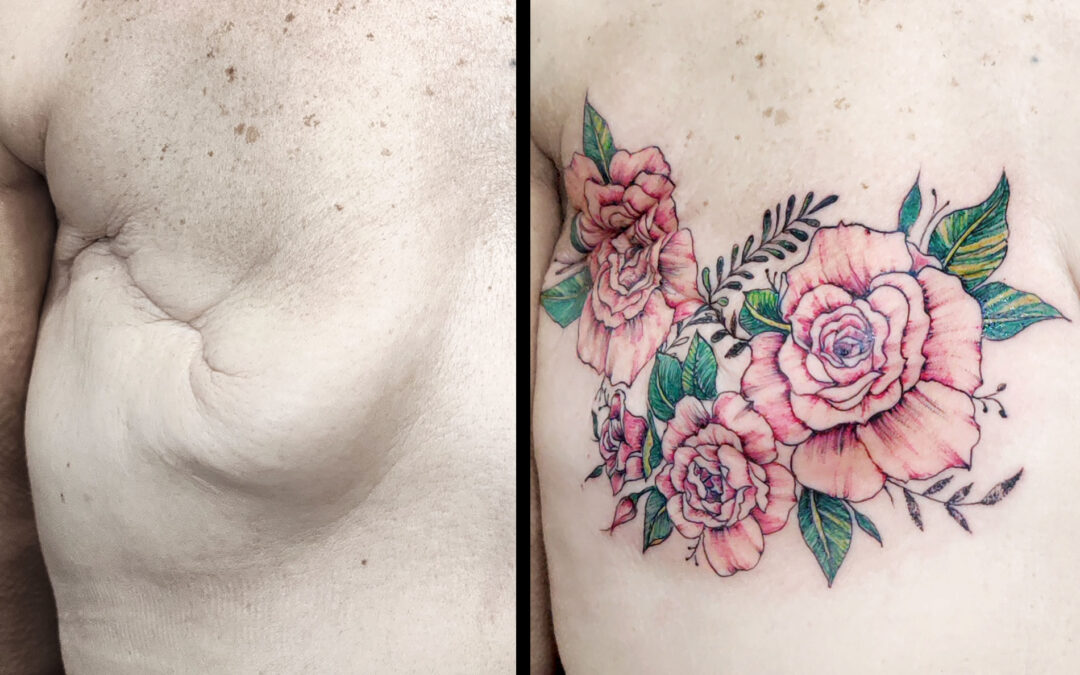 Tatuaje reparador en Sevilla