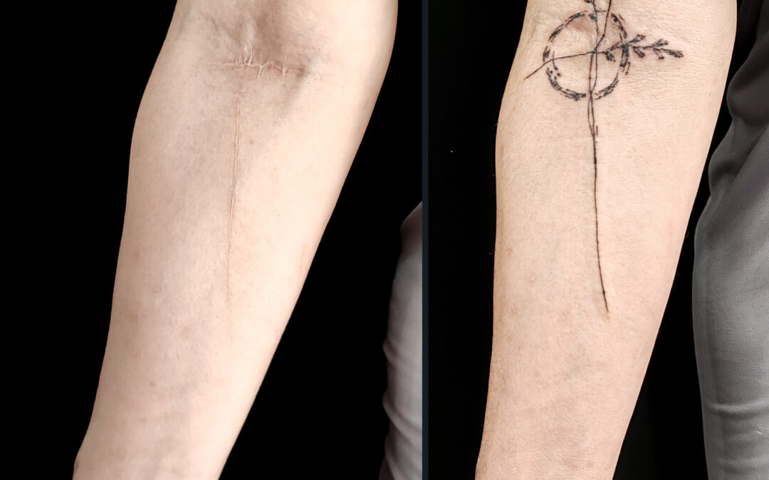 El tatuaje reparador ayuda a la mente y al alma