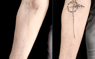 El tatuaje reparador ayuda a la mente y al alma
