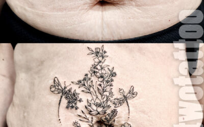Tatuaje sobre estrías