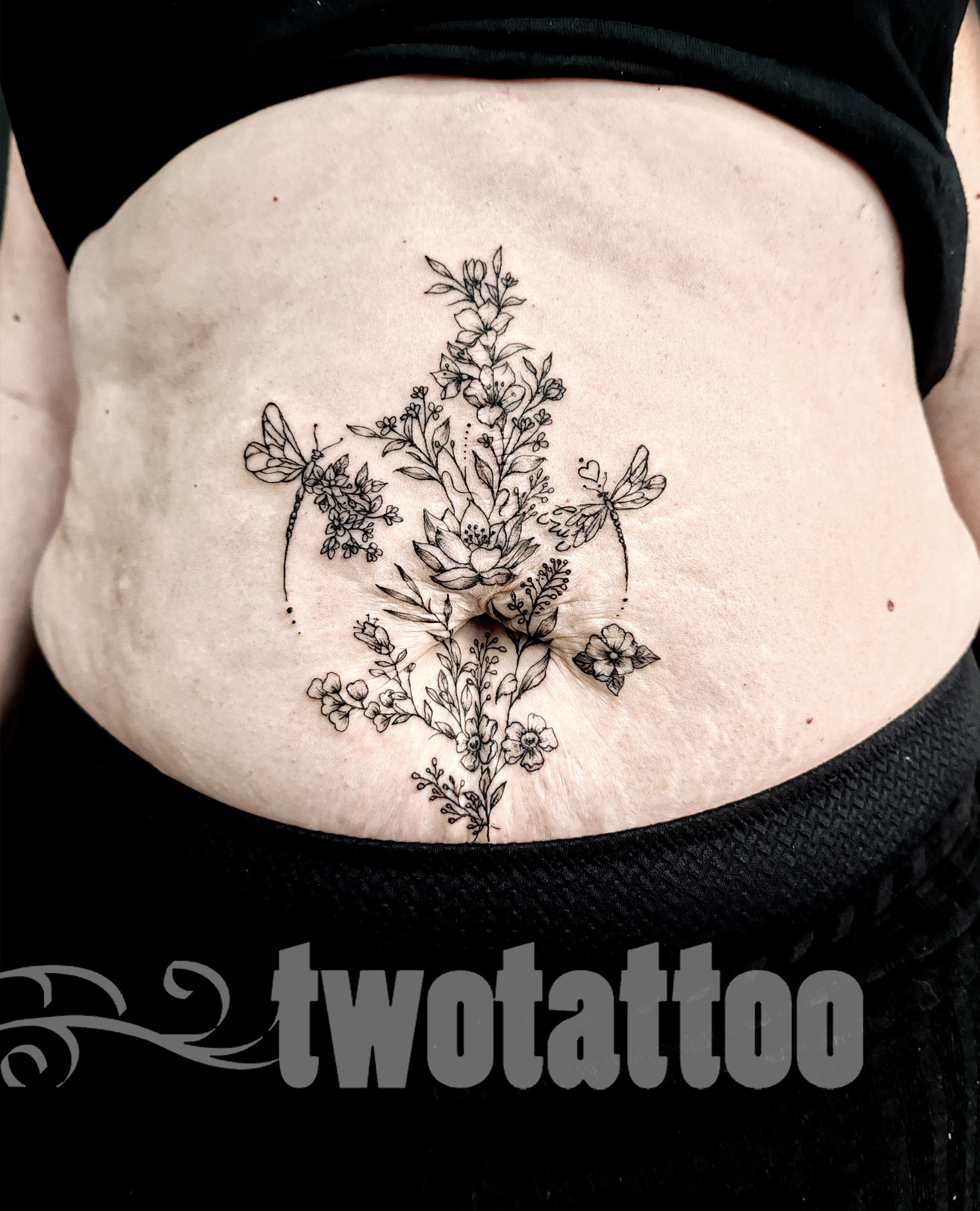 Tatuaje reparador sobre estrias. 