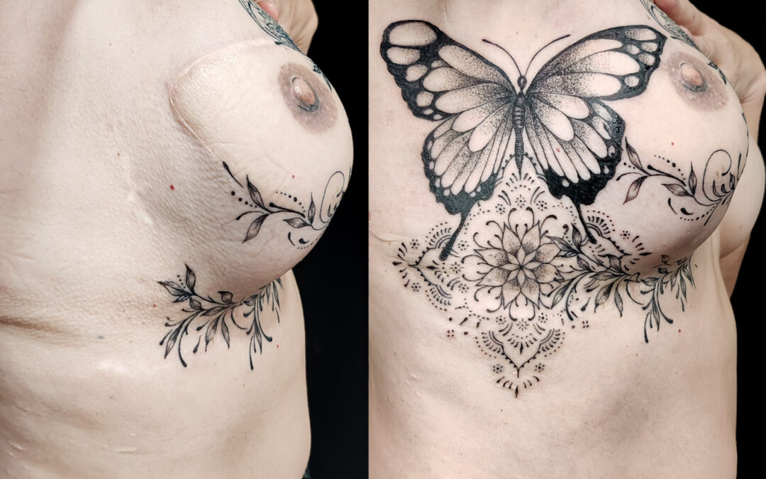 Tatuaje tras un cáncer de mamas