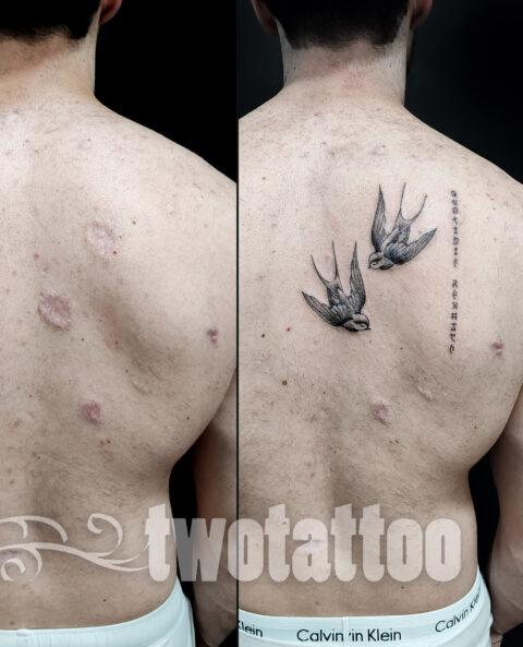 Tatuaje sobre cicatrices. Sevilla