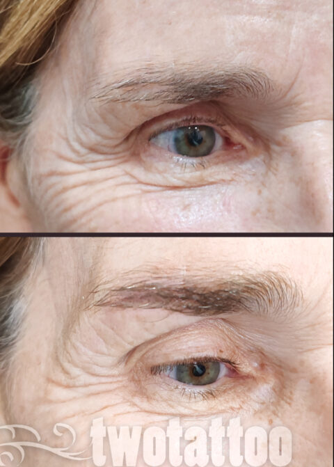 cicatriz en ceja cubierta por tatuaje