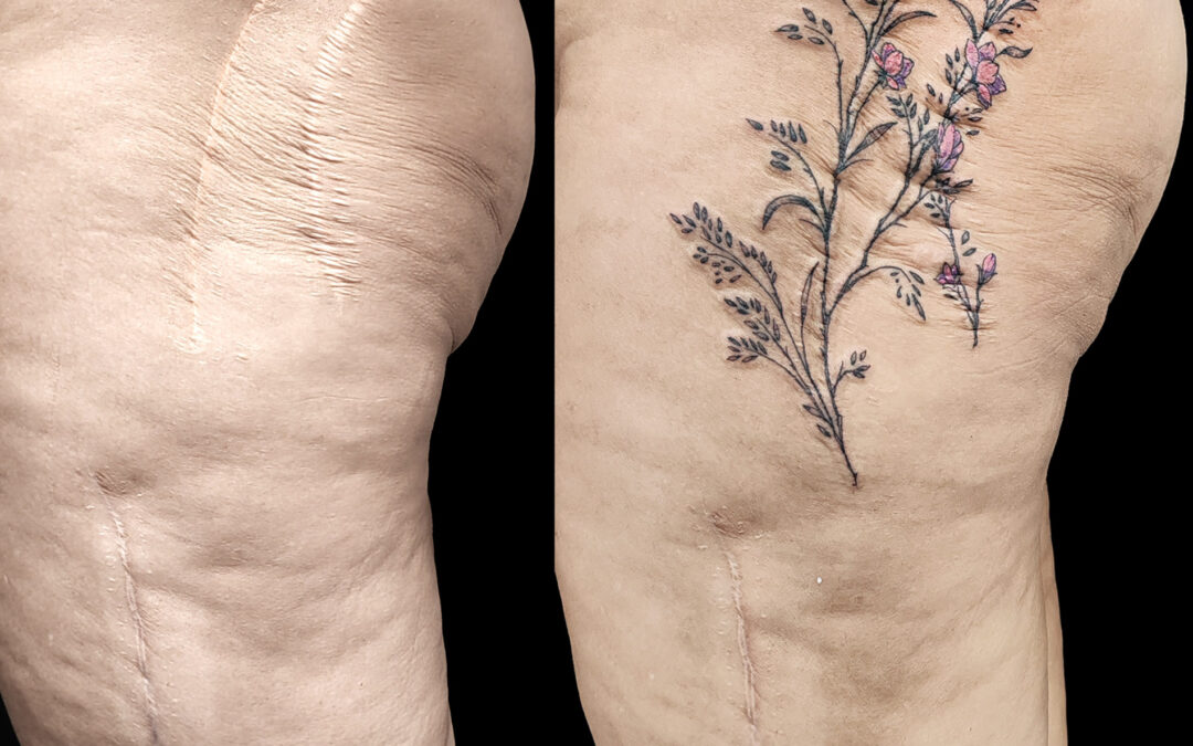 Tatuaje sobre cicatrices. Una durísima historia.