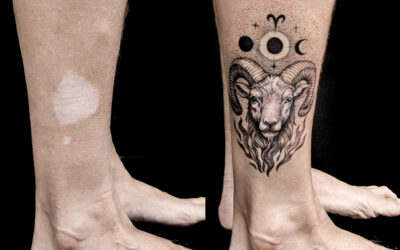 Tatuaje sobre manchas despigmentadas en la piel