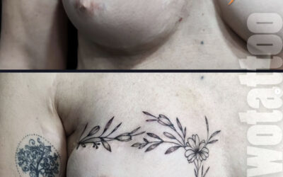 Tatuaje  Mastectomía gratuito